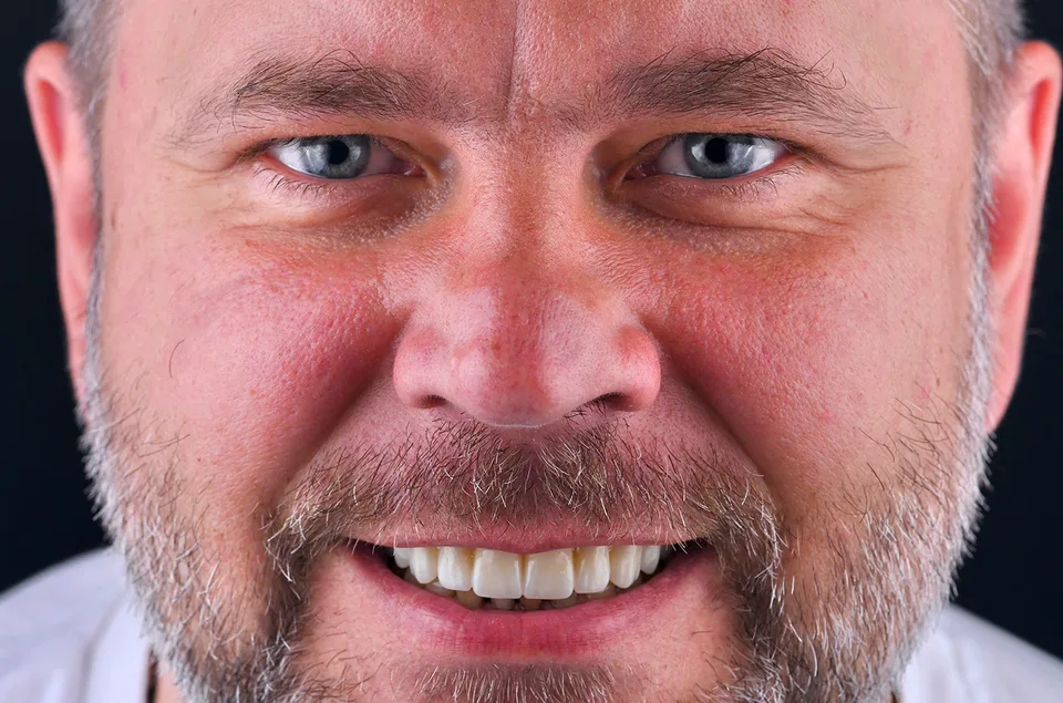 Vaka 2 · sonra
