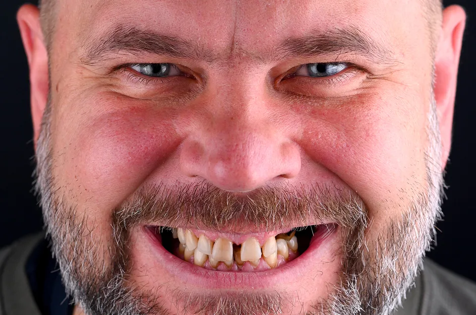 Vaka 2 · önce
