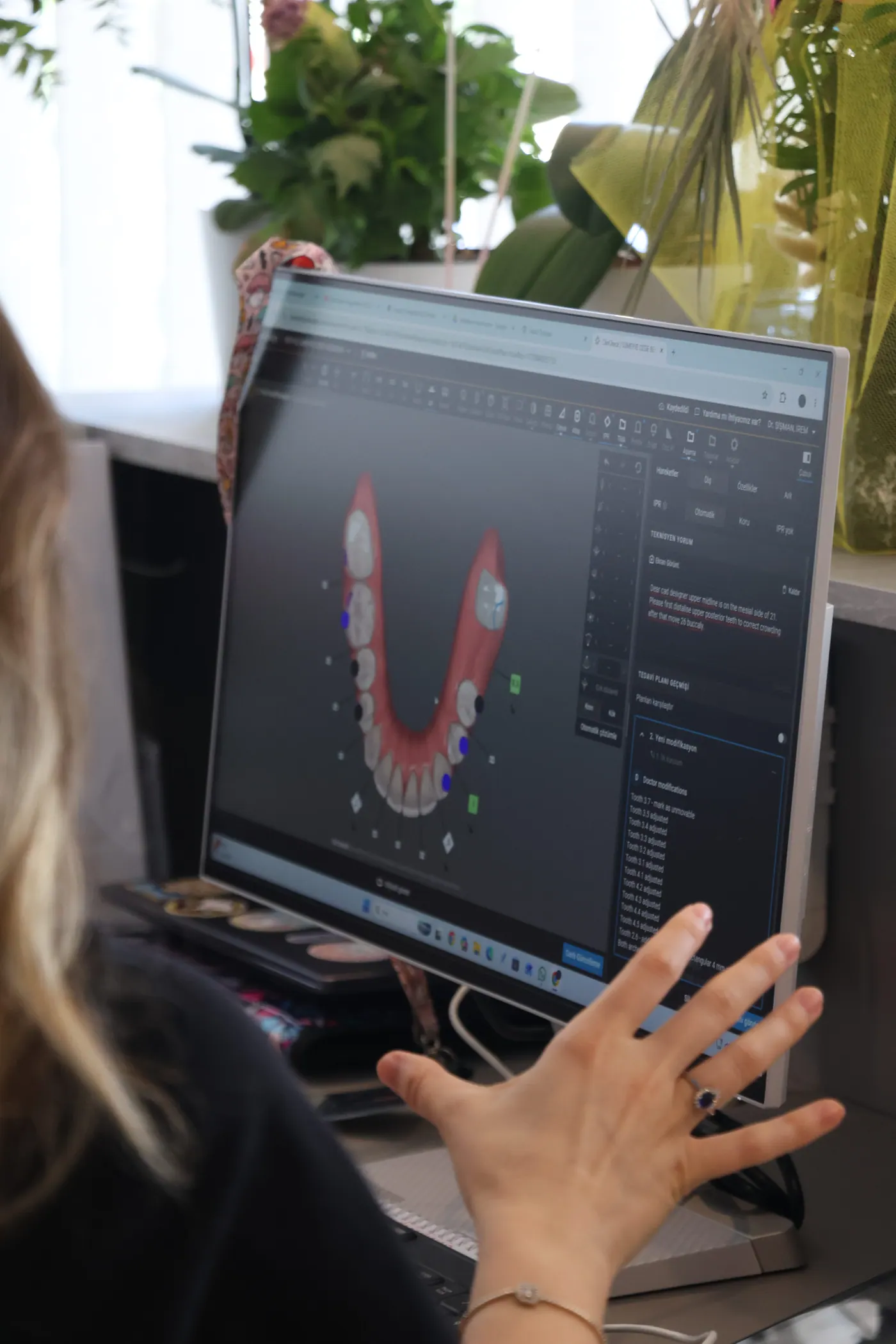 3D ortodonti planlaması ekranda